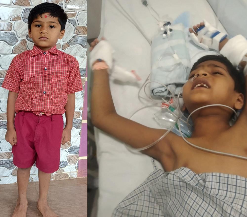 بھٹکل کا پانچ سالہ معصوم؛ جگر کی خطرناک بیماری میں مبتلا، فوری علاج کے لیے عوام سے تعاون کی اپیل
